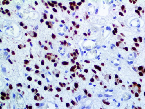 IHC of SOX-2 on an FFPE Brain Tissue